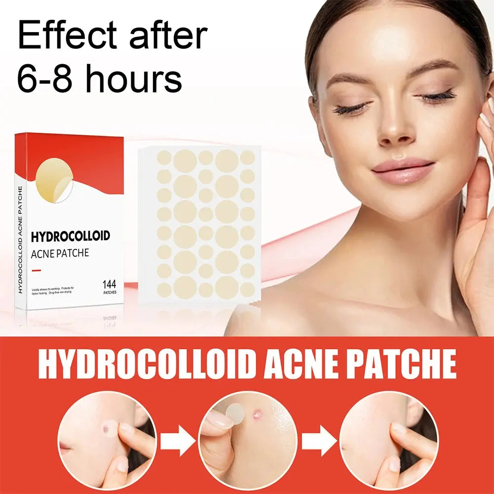 144pcs Invisible Acne Pimple Patches (2 Sizes) HypeNvibes